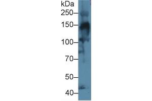 Detection of COL4a3 in Mouse Skeletal muscle lysate using Polyclonal Antibody to Collagen Type IV Alpha 3 (COL4a3) (COL4a3 抗体  (AA 1428-1670))