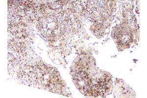 IHC analysis of LCP1 using anti-LCP1 antibody (ABIN6719421). (LCP1 抗体)