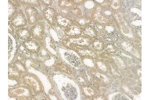 ABIN6255413 and ABIN6267124 at 1/100 staining human normal kidney tissue by IHC-P. (LIPE 抗体  (pSer563, pSer853))