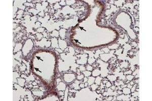 Expression of TRPM4 in rat lung - Immunohistochemical staining of rat lung paraffin embedded sections using Anti-TRPM4 Antibody (ABIN7043833, ABIN7044008 and ABIN7044009), (1:100). (TRPM4 抗体  (Intracellular))