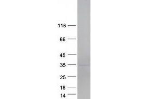 Western Blotting (WB) image for Chromosome 18 Open Reading Frame 1 (C18orf1) protein (Myc-DYKDDDDK Tag) (ABIN2718591)