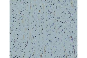 IHC analysis of Cyclophilin E/PPIE using anti-Cyclophilin E/PPIE antibody (ABIN7599243). (PPIE 抗体  (AA 1-301))