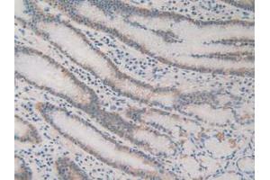 IHC-P analysis of Human Stomach Tissue, with DAB staining. (ACAT2 抗体  (AA 1-397))