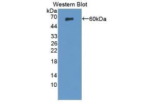 anti-Tissue Factor Pathway Inhibitor (Lipoprotein-Associated Coagulation Inhibitor) (TFPI) (AA 29-304) antibody