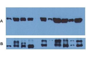 Western Blotting (WB) image for anti-alpha Tubulin (TUBA1) antibody (FITC) (ABIN93892)
