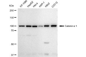 Western blotting analysis using Catenin alpha 1 antibody (ABIN7797923). (Recombinant CTNNA1 抗体)