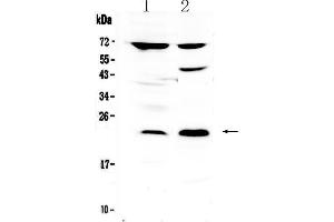 Western blot analysis of TRFP / MED20 using anti-TRFP / MED20 antibody . (MED20 抗体  (AA 1-212))