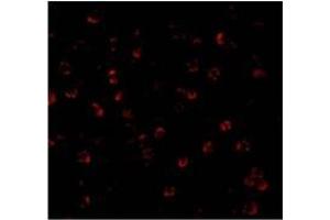 Immunofluorescence of ATG7 in MCF7 cells with ATG7 Antibody at 20 µg/ml. (ATG7 抗体  (C-Term))
