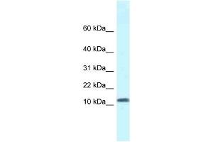 Western Blot showing SSBP1 antibody used at a concentration of 1 ug/ml against Fetal Kidney Lysate (SSBP1 抗体  (N-Term))