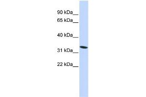 WB Suggested Anti-HMG20A Antibody Titration: 0. (HMG20A 抗体  (N-Term))
