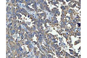 IHC analysis of TRAM1L1 using anti-TRAM1L1 antibody (ABIN7602939).