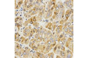 Immunohistochemistry (Paraffin-embedded Sections) (IHC (p)) image for anti-Tropomyosin-2 (TPM2) antibody (ABIN3017365)