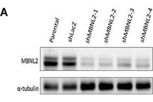 Western Blotting (WB) image for anti-Tubulin, alpha 1B (TUBA1B) antibody (ABIN2855283)