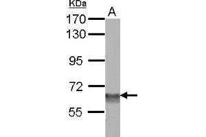 Western Blotting (WB) image for anti-SWI/SNF Related, Matrix Associated, Actin Dependent Regulator of Chromatin, Subfamily D, Member 3 (SMARCD3) (AA 105-441) antibody (ABIN1501913) (SMARCD3 抗体  (AA 105-441))