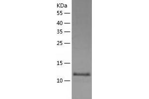 FABP12 Protein (AA 1-140) (His tag)