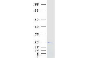Western Blotting (WB) image for GINS Complex Subunit 2 (Psf2 Homolog) (GINS2) protein (Myc-DYKDDDDK Tag) (ABIN2721880)