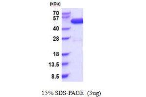 SDS-PAGE (SDS) image for C-Src tyrosine Kinase (CSK) (AA 1-450) protein (His tag) (ABIN5853916) (CSK Protein (AA 1-450) (His tag))