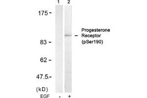 Western blot analysis of extracts from SKOV3 cells untreated(lane 1) or treated with EGF(lane 2) using Progesterone Receptor(Phospho-Ser190) Antibody. (Progesterone Receptor 抗体  (pSer190))