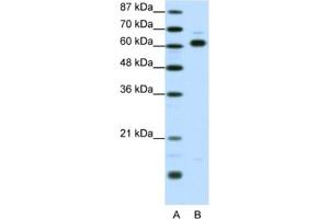 Western Blotting (WB) image for anti-Thyroid Hormone Receptor Interactor 4 (TRIP4) antibody (ABIN2461241) (TRIP4 抗体)