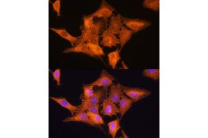 Immunofluorescence analysis of C6 cells using ALDOC Rabbit pAb (ABIN6129897, ABIN6136788, ABIN6136789 and ABIN6215308) at dilution of 1:100. (ALDOC 抗体  (AA 1-170))