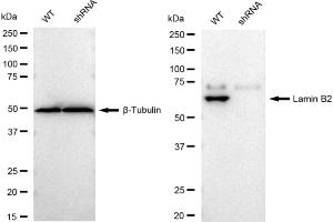 Western blotting analysis using Lamin B2 antibody (ABIN7799233). (Recombinant Lamin B2 抗体)