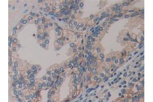 Detection of MCP in Human Prostate Tissue using Polyclonal Antibody to Membrane Cofactor Protein (MCP) (CD46 抗体  (AA 147-285))