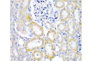 Immunohistochemistry of paraffin-embedded Rat kidney using UPF2 Polyclonal Antibody at dilution of 1:200 (40x lens). (RENT2/UPF2 抗体)