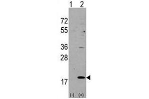 Image no. 3 for anti-Hippocalcin-Like 1 (HPCAL1) (N-Term) antibody (ABIN357110) (HPCAL1 抗体  (N-Term))