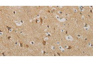 Immunohistochemistry of paraffin-embedded Human brain using IDH3G Polyclonal Antibody at dilution of 1:30 (IDH3G 抗体)