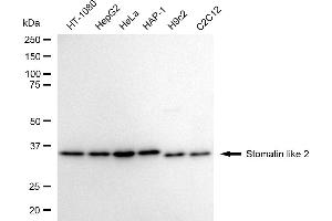 Western blotting analysis using Stomatin like 2 antibody (ABIN7800442). (Recombinant STOML2 抗体)