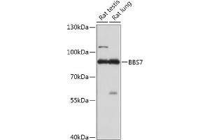 Western blot analysis of extracts of various cell lines, using BBS7 antibody (ABIN7265825) at 1:1000 dilution. (BBS7 抗体  (AA 1-270))