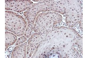 IHC-P Image Immunohistochemical analysis of paraffin-embedded Cal27 xenograft, using Aspartoacylase, antibody at 1:100 dilution. (ASPA 抗体)