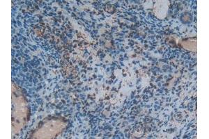 Detection of S100A6 in Rat Ovary Tissue using Polyclonal Antibody to S100 Calcium Binding Protein A6 (S100A6) (S100A6 抗体  (AA 1-89))