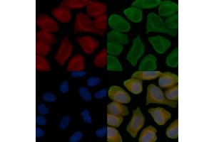 C14orf37 Antibody staining Hela cells(45 min of heat-shock treatment) by IF/ICC. (C14ORF37 抗体)