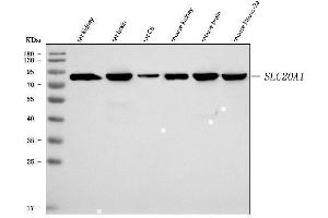 Western blot analysis of SLC20A1 using anti-SLC20A1 antibody (ABIN7602463).