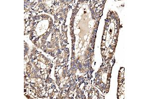 IHC analysis of MPPB/PMPCB using anti-MPPB/PMPCB antibody (ABIN7600758). (PMPCB 抗体  (AA 23-479))
