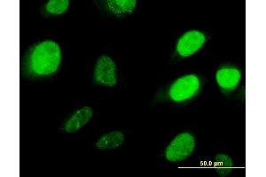 Immunofluorescence of monoclonal antibody to HOXD3 on HeLa cell. (HOXD3 抗体  (AA 334-431))