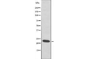 Western blot analysis of extracts from HepG2 cells using HSPB2 antibody. (HSPB2 抗体  (Internal Region))