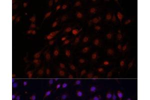Immunofluorescence analysis of C6 cells using Bcl-2 Polyclonal Antibody at dilution of 1:100 (40x lens). (Bcl-2 抗体)