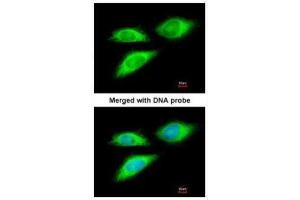 ICC/IF Image Immunofluorescence analysis of paraformaldehyde-fixed HeLa, using BAG5, antibody at 1:200 dilution. (BAG5 抗体)