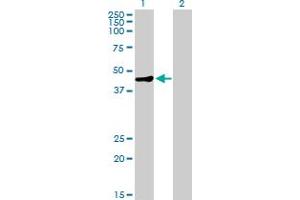 Western Blot analysis of MAGEA9 expression in transfected 293T cell line by MAGEA9 MaxPab polyclonal antibody. (MAGEA9 抗体  (AA 1-315))