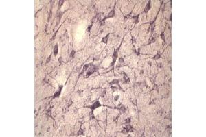 IHC on rat spinal cord using Rabbit antibody to extracellular, N-terminal part of Sortilin (Neurotensin receptor 3, NTR3, Sort1): IgG (ABIN350868) at a concentration of 10 µg/ml. (Sortilin 1 抗体)