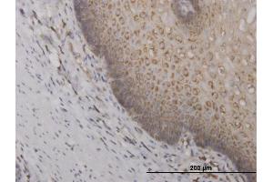Immunoperoxidase of monoclonal antibody to RPS2 on formalin-fixed paraffin-embedded human esophagus. (RPS2 抗体  (AA 198-293))