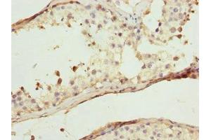 Immunohistochemistry of paraffin-embedded human testis tissue using ABIN7175708 at dilution of 1:100 (WIPI2 抗体  (AA 205-454))