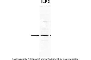 Western Blotting (WB) image for anti-Interleukin Enhancer Binding Factor 2, 45kDa (ILF2) (C-Term) antibody (ABIN2776419)