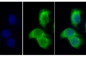 Detection of PDHb in Human Hela cell using Polyclonal Antibody to Pyruvate Dehydrogenase Beta (PDHb) (PDHB 抗体  (AA 31-341))