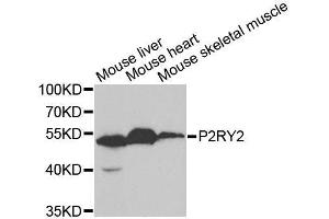 Western blot analysis of extracts of various cell lines, using P2RY2 antibody. (P2RY2 抗体  (AA 278-377))