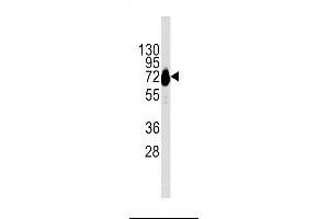 Western blot analysis of CDH10 Antibody in NCI-H460 cell line lysates (35ug/lane) (CDH10 抗体  (C-Term))