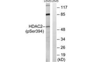 Western blot analysis of extracts from LOVO cells, using HDAC2 (Phospho-Ser394) Antibody. (HDAC2 抗体  (pSer394))