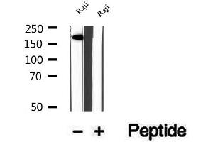 Western blot analysis of extracts of Raji cells, using KIDINS220 antibody. (KIDINS220 抗体  (Internal Region))